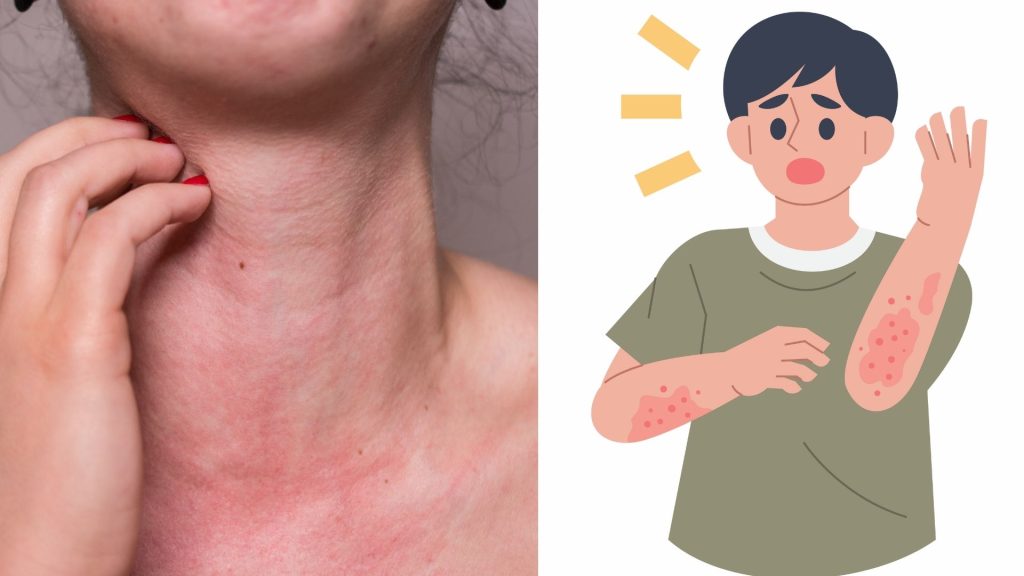 tac hai cap tinh cua tra thao moc